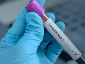 Confirmas primer caso de Coronavirus en BCS